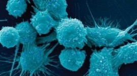 Самый высокий уровень заболеваемости раком зафиксирован в Лорийской области